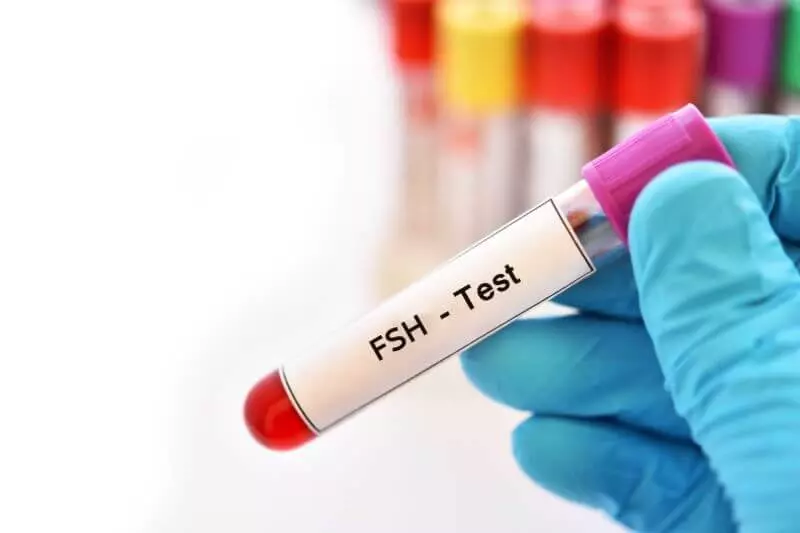 Follicle Stimulating Hormone (FSH) Levels