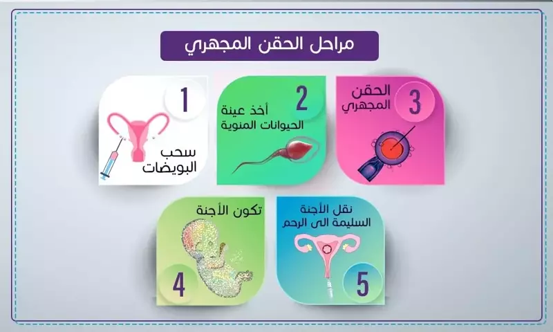الحقن المجهري