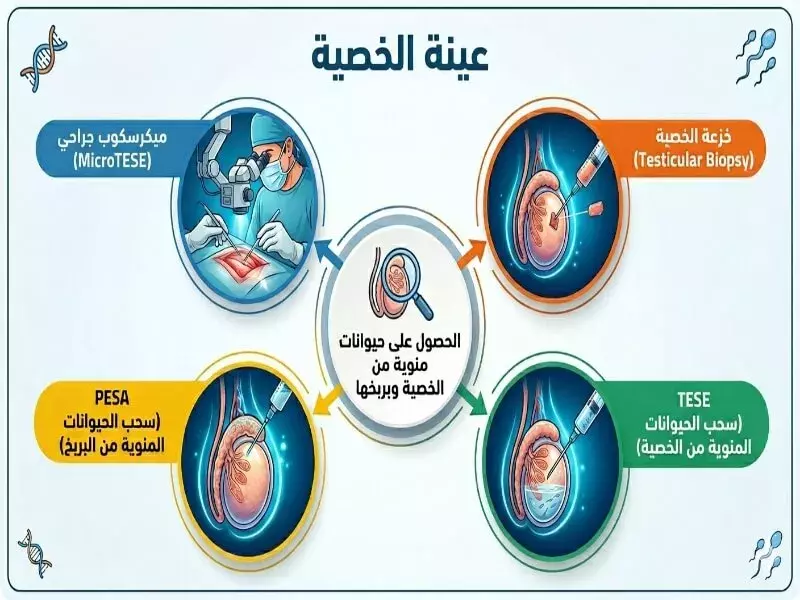 Testicular Biopsy
