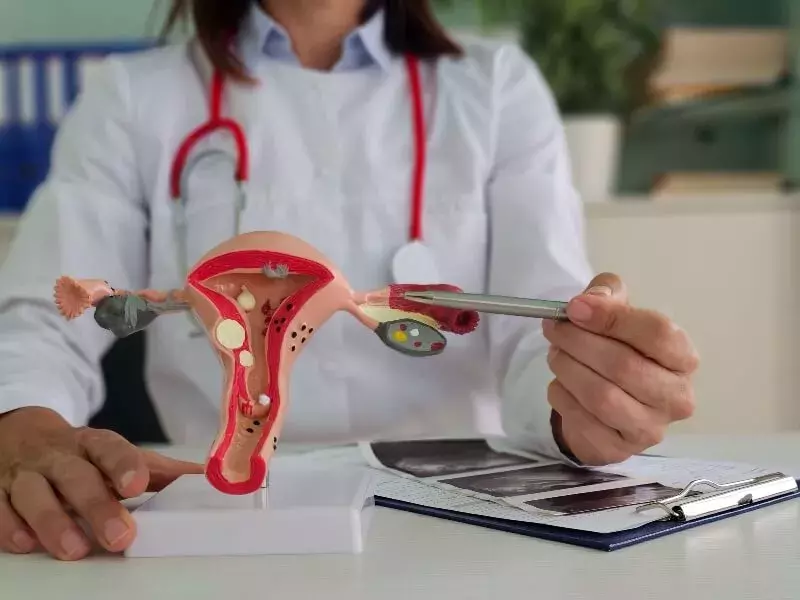 متى يكون كيس المبيض خطير ؟