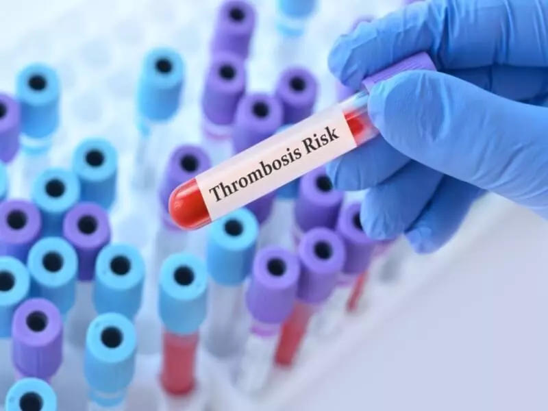 Thrombophilia profile test